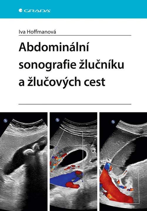 Kniha: Abdominální sonografie žlučníku a žlučových cest od Hoffmanová Iva