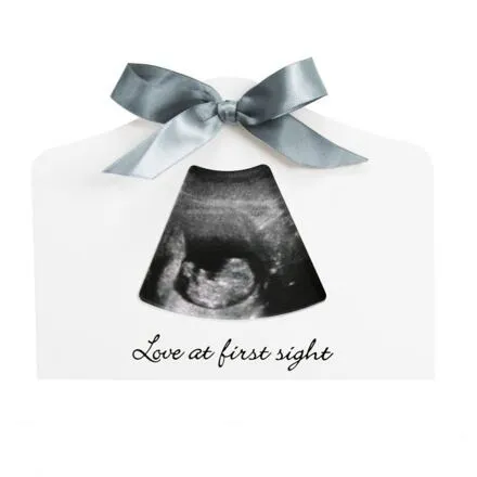 Happy Hands rámček na sono Echo Frame